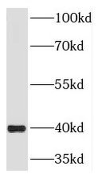 DNAJA3 Rabbit Polyclonal Antibody