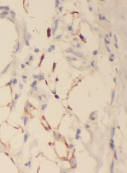 DNAJA3 Rabbit Polyclonal Antibody