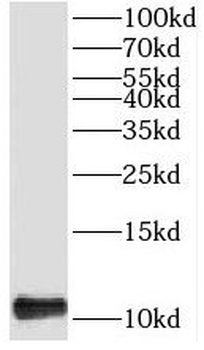 TIMM13 Rabbit Polyclonal Antibody