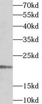 TIMM17A Antibody