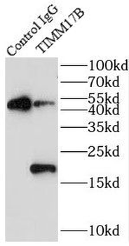TIMM17B Antibody