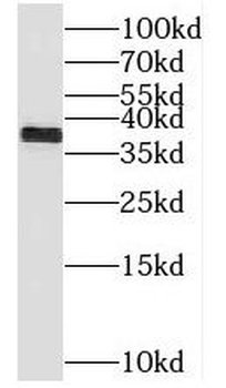 TIMM50 Rabbit Polyclonal Antibody