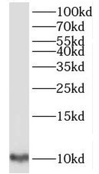 TIMM9 Rabbit Polyclonal Antibody