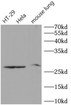 TIMP1 Antibody