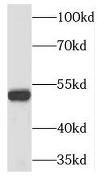 TINF2 Rabbit Polyclonal Antibody