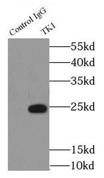 TK1 Antibody