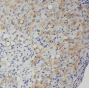 TLR5 Rabbit Polyclonal Antibody