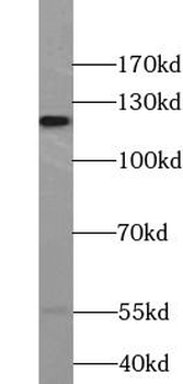 TLR7 Rabbit Polyclonal Antibody