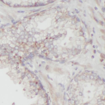 TMEFF2 Antibody