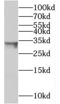 TMEM106B Antibody