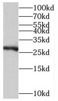 TMEM176A Rabbit Polyclonal Antibody