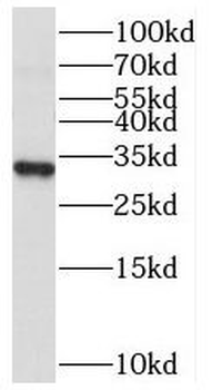 CLTRN Rabbit Polyclonal Antibody