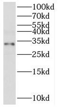 CLTRN Rabbit Polyclonal Antibody