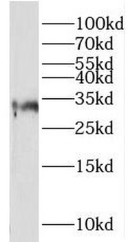 CLTRN Rabbit Polyclonal Antibody