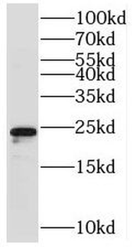 TMEM98 Rabbit Polyclonal Antibody