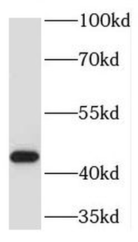 TMLHE Rabbit Polyclonal Antibody