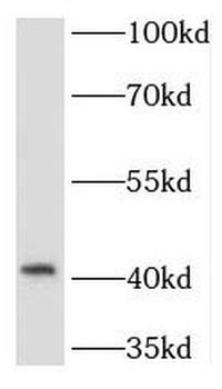 TMOD1 Rabbit Polyclonal Antibody