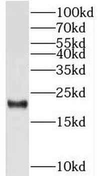 TMED10 Rabbit Polyclonal Antibody