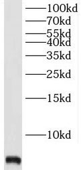 TMSB4X Rabbit Polyclonal Antibody