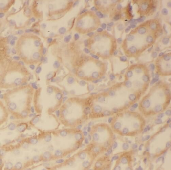 TMX2 Rabbit Polyclonal Antibody