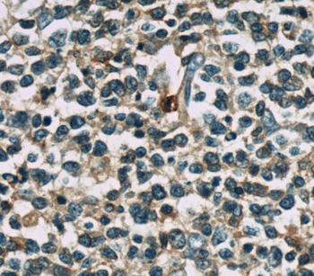 TNFAIP8 Antibody