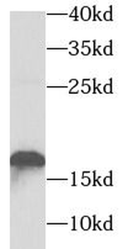 TNNC2 Rabbit Polyclonal Antibody