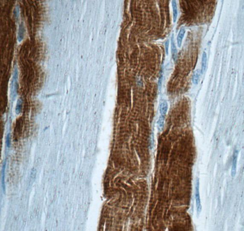 TNNI2 Antibody