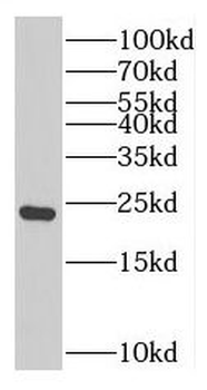 TNNI2 Antibody