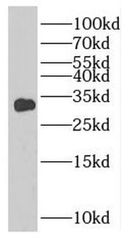 TNNT1 Antibody