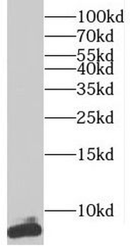 TNP1 Rabbit Polyclonal Antibody
