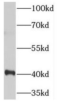 TOB1 Rabbit Polyclonal Antibody