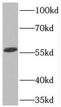 TOE1 Rabbit Polyclonal Antibody
