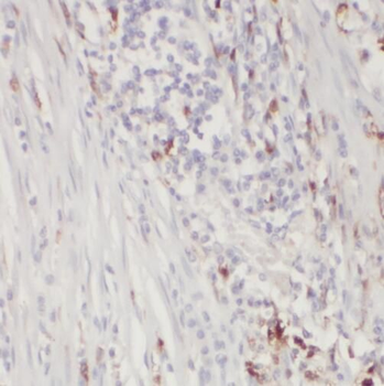 TOE1 Rabbit Polyclonal Antibody