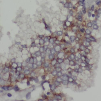 TOM1L1 Antibody