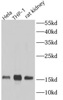 TOMM20 Rabbit Polyclonal Antibody
