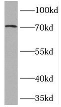 TOP1MT Rabbit Polyclonal Antibody