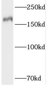 TOP2B Rabbit Polyclonal Antibody