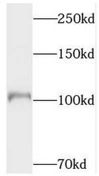 TOP3A Rabbit Polyclonal Antibody
