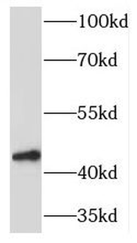 TOR1A Rabbit Polyclonal Antibody
