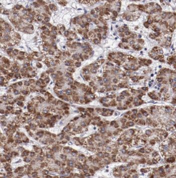 TP53INP1 Rabbit Polyclonal Antibody