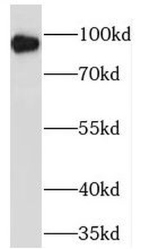 TPCN1 Rabbit Polyclonal Antibody