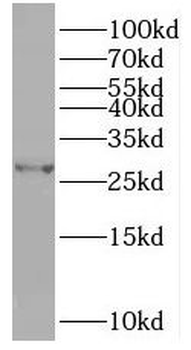 TPK1 Rabbit Polyclonal Antibody
