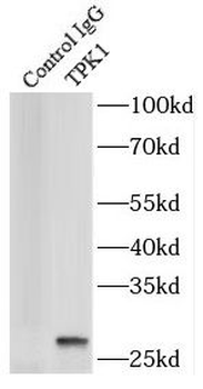 TPK1 Rabbit Polyclonal Antibody