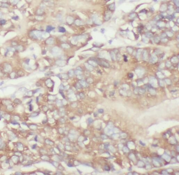 TPK1 Rabbit Polyclonal Antibody