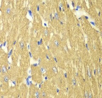 TPM3 Rabbit Polyclonal Antibody