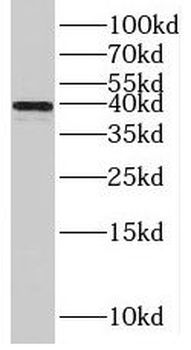 TPM3 Rabbit Polyclonal Antibody