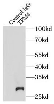 TPM4 Antibody