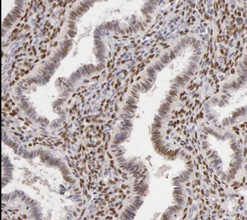 TPM4 Antibody