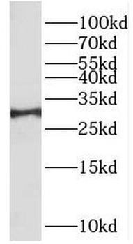 TPMT Rabbit Polyclonal Antibody