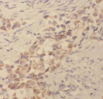 TPMT Rabbit Polyclonal Antibody